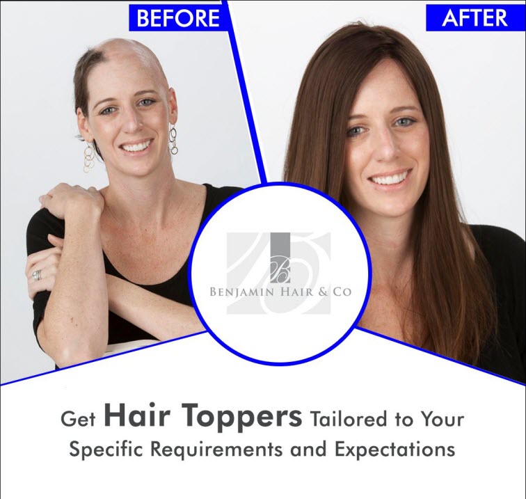 Hair Toppers Vs Hair Wigs - Which Is Right For You? Hair Toppers Vs Hair Wigs - Which Is Right For You?