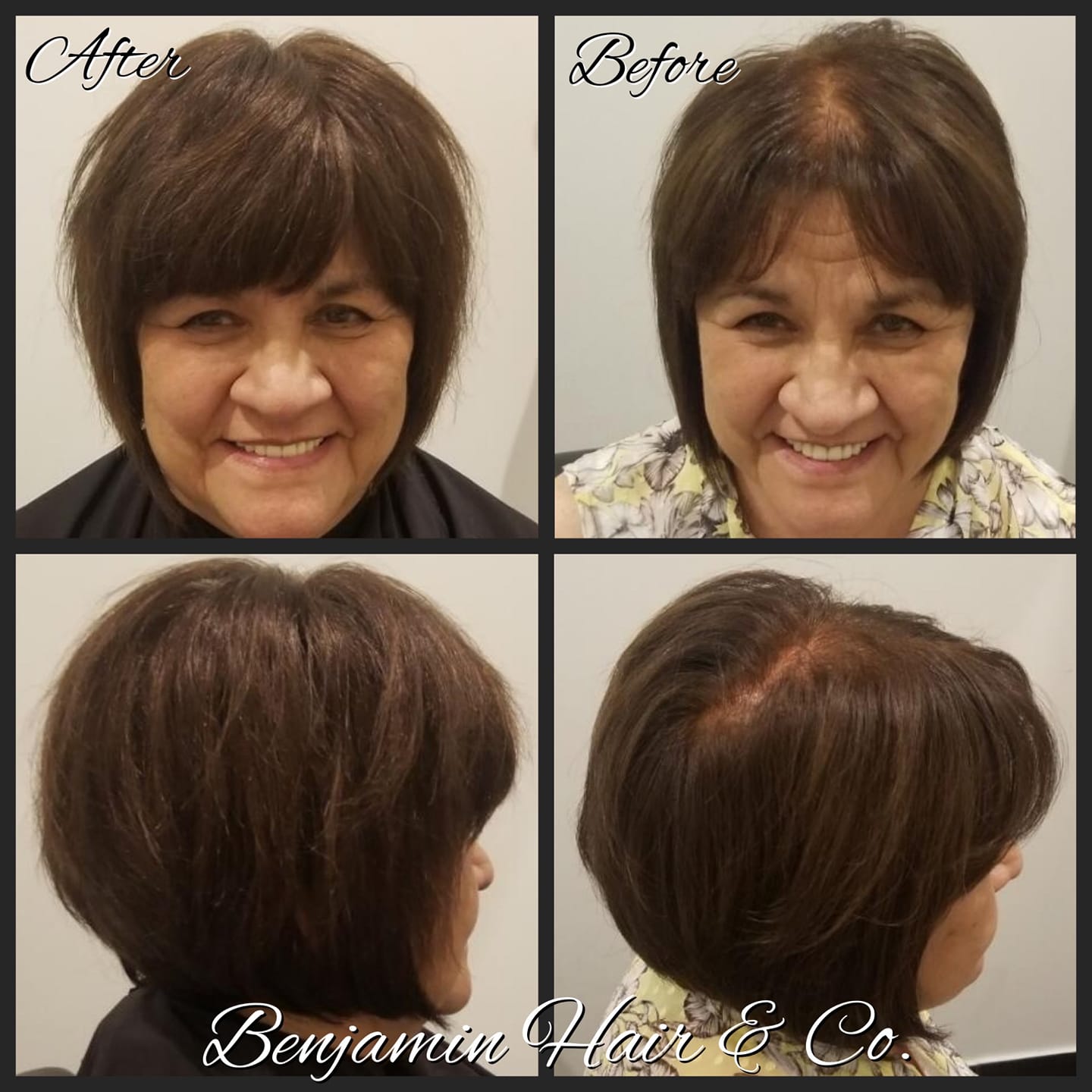 Different Types of Women Hair Loss Solutions Where to get them
